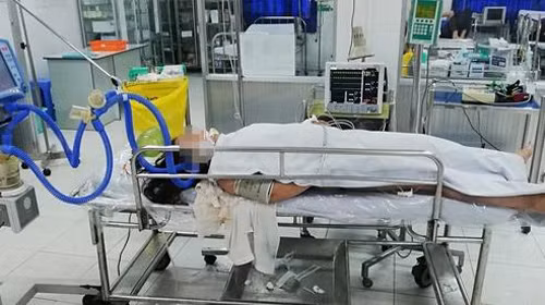 Suc khoe nu du khach bi set danh khi tam bien dang nguy kich