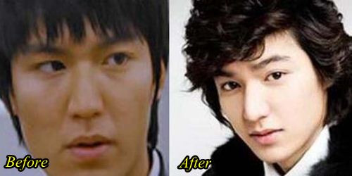 Mỹ nam đình đám châu Á Lee Min Hoo cũng vướng nghi vấn phẫu thuật mũi.