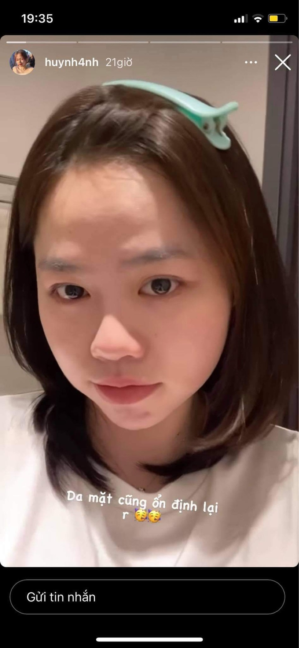 Mới đây, bạn gái Quang Hải - Huỳnh Anh trở thành tâm điểm gây xôn xao khi đăng tải những bức ảnh gương mặt mộc mạc, không trang điểm, khoe làn da láng mịn lên trang cá nhân Instagram.