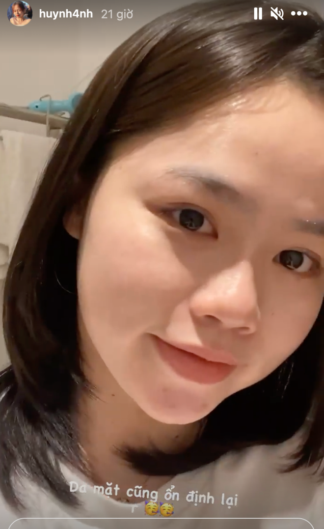 Cô nàng tích cực khoe những hình ảnh cá nhân của mình trên MXH. Làn da được Huỳnh Anh khoe là "mịn màng" cũng lộ vài chỗ lấm tấm mụn dưới phần cằm.