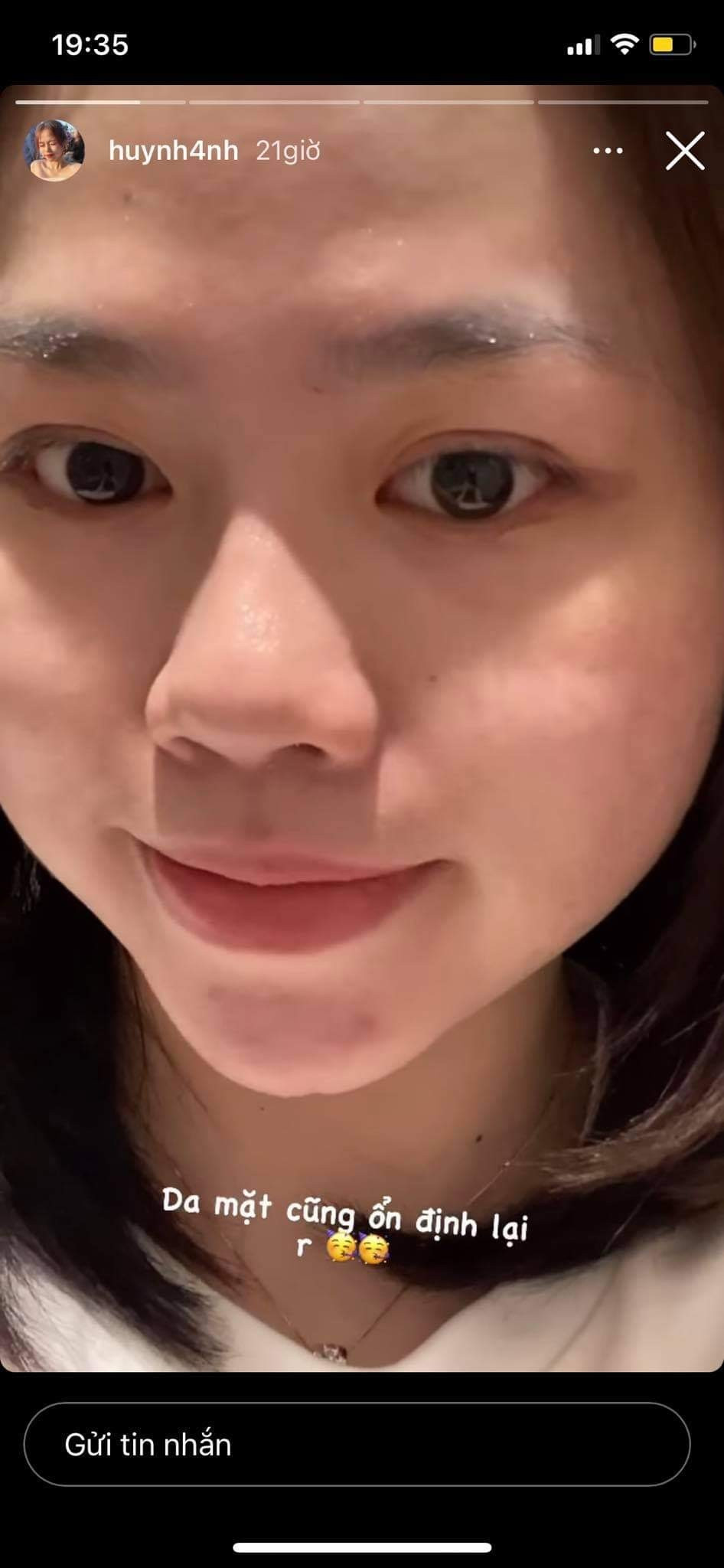 Hình ảnh mặt mộc của Huỳnh Anh được nhận xét là có hơi nhợt nhạt hơn từ sau khi chia tay với Quang Hải.