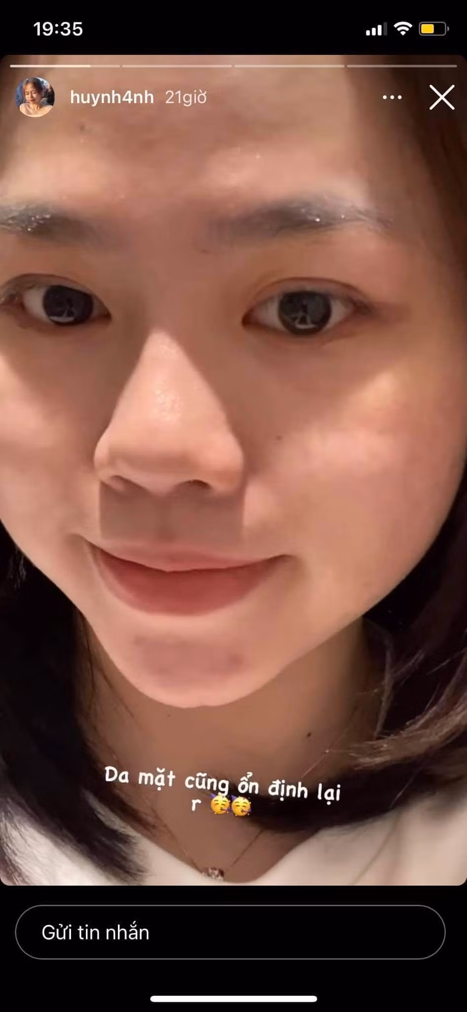 Hình ảnh mặt mộc của Huỳnh Anh được nhận xét là có hơi nhợt nhạt hơn từ sau khi chia tay với Quang Hải.