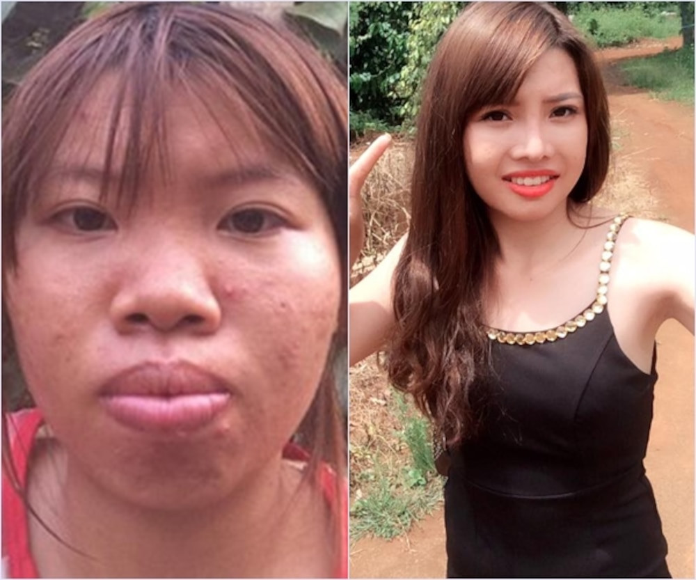 ''Phượng Thị Nở'' tên thật là Quách Thị Kim Phượng (sinh năm 1995, quê Đăk Nông) từng gây sốt với câu chuyện phẫu thuật thẩm mỹ hồi năm 2017.