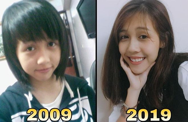 Hậu Hoàng - nàng vlogger nổi tiếng trên MXH có màn "lột xác" ấn tượng. Theo chia sẻ của Hậu Hoàng thì chính việc niềng răng đã giúp cô thay đổi về ngoại hình.