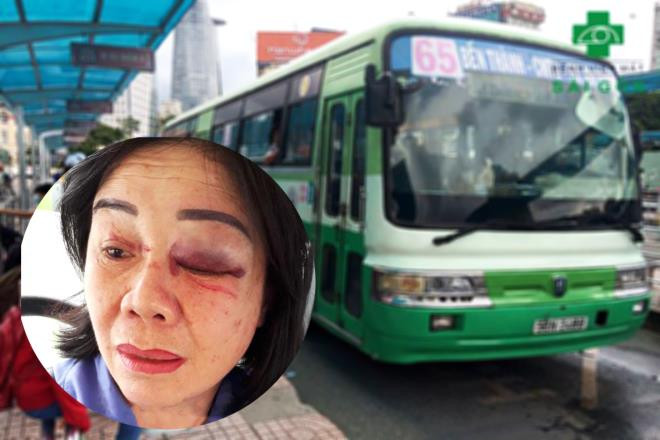  3. Nhắc khách mở nhạc nhỏ bị đấm sưng mặt: Ngày 4/8, bà Oanh làm công việc tiếp viên trên xe buýt số 65 nhắc một hành khách nam mở nhỏ nhạc khi đang ở trên xe bus nên xảy ra cự cãi. Hành khách này khó chịu nên đã lao vào hành hung bà Oanh thâm tím vùng mắt. Khi xe dừng, cửa mở người này bỏ đi mất.