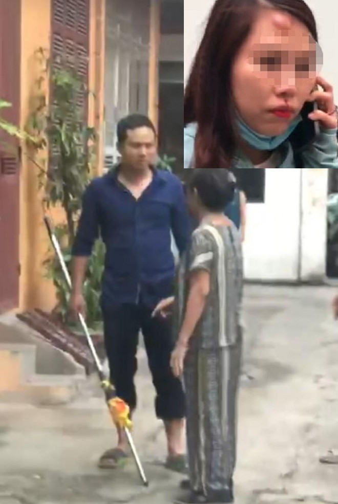 3. Nam thanh niên dùng gậy đánh tới tấp vào mặt phụ nữ: Chị A. (SN 1987, trú TP Hà Nội) tan học tại trung tâm ngõ 106 Chùa Láng (Đống Đa, Hà Nội), thấy một người đàn ông to tiếng với bạn nên yêu cầu chủ trung tâm xuống giải quyết. Ngay sau đó chị bị người này dùng gậy sắt vụt vào mặt liên tiếp dẫn đến thương tích.