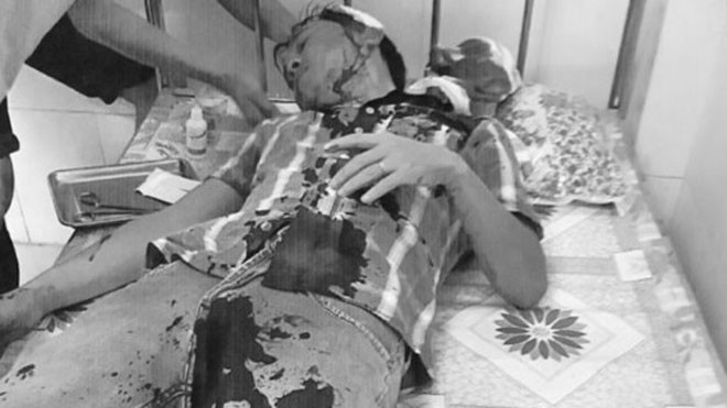  3. Thuê “giang hồ” chém đối thủ giá 5 triệu đồng: Danh Phương (SN 1983) làm nghề mua bán tại Cảng cá Tắc Cậu (huyện Châu Thành) có cạnh tranh với Lê Văn Thống (SN 1987) trong việc giành mối mua cá nên Danh Phương đã thuê Phan Văn Sửu và Trần Ngọc Sự đánh anh Thống để dằn mặt với số tiền 5 triệu đồng. Anh Thống bị vỡ xương sọ thái dương đỉnh trái, tụ máu dưới màng cứng thái dương, xuất huyết.... tỷ lệ tổn thương do thương tích gây ra là 32%.