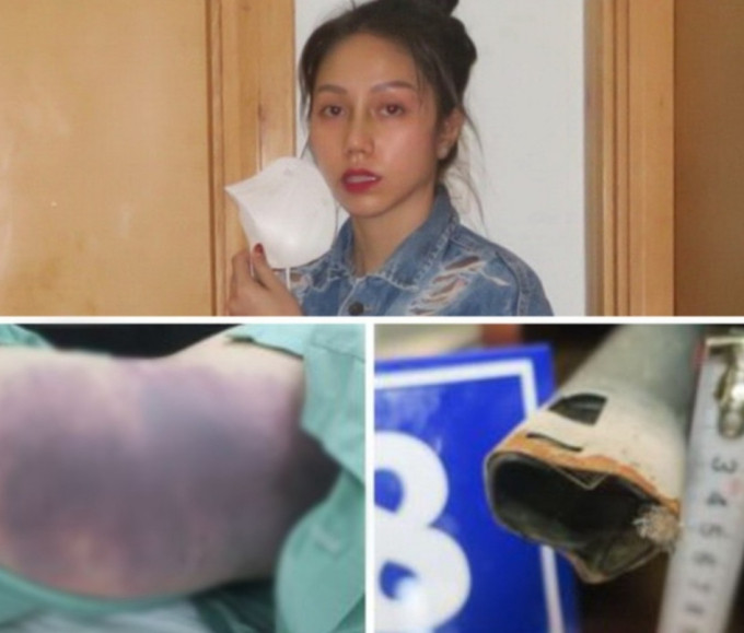 Từ 22h14 phút ngày 10/12/2021 tới 2h16 phút ngày 11/12/2021, Trang và Thái thay phiên nhau dùng roi, dùng cây kim loại đánh cháu A. trong tình trạng cháu A. không mặc quần áo. Trang dùng tay bóp cổ cháu A. còn Thái cầm roi đánh vào đầu cháu A. 