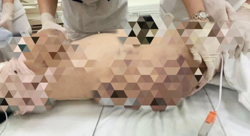 Sau khi Trang đánh xong, Thái phát hiện con gái bị chảy máu trên đầu, nên sơ cứu và đưa đến bệnh viện khâu vết thương. Mặc dù cháu bị thương nhưng đến 16h57 phút chiều cùng ngày, Trang tiếp tục dùng tay chân và cây kim loại (ống nối của máy hút bụi) đánh. Đến 16h 30 phút, Trang và Thái ra khỏi nhà nhưng vẫn bắt cháu quỳ gối ở nhà, Trang và Thái theo dõi qua camera. Khi Trang và Thái về nhà, từ 19h57 phút đến 20h20 cùng ngày, Trang tiếp tục bắt cháu A. cởi quần rồi dùng cây kim loại đánh. Trong khoảng thời gian này, Thái nhìn thấy Trang đánh cháu A. nhưng không can ngăn. 