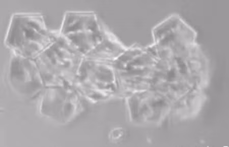 Nhung do vat ti hon gay sung sot nhat-Hinh-6