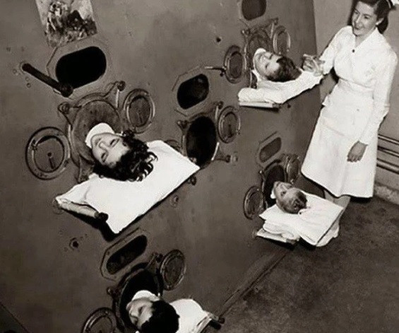 Trong ảnh là hình ảnh những người bệnh nằm trong một chiếc "iron lung" (hay còn gọi là phổi nhân tạo) để điều trị bệnh vào năm 1937. Đây là một sáng chế kỳ quặc của người xưa.