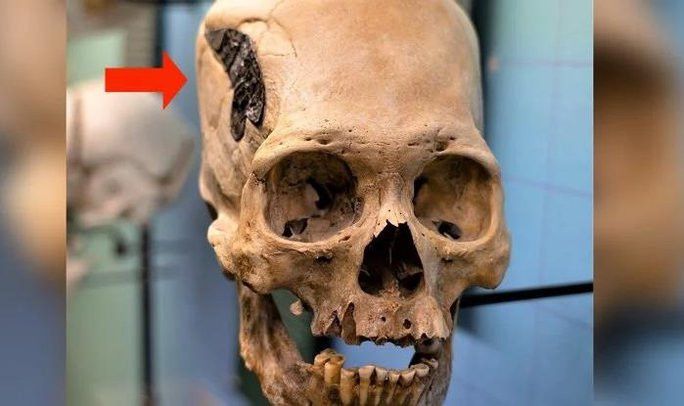 Theo các chuyên gia, hộp sọ trên có nguồn gốc từ Peru, có niên đại khoảng 2.000 tuổi. Hộp sọ có hình dáng thuôn dài được cho có thể là xuất phát từ tập tục cổ xưa của người Peru. Vào thời cổ đại, người lớn sẽ thực hiện các giải pháp nhằm siết chặt đầu trẻ em để tạo hình sọ dài.