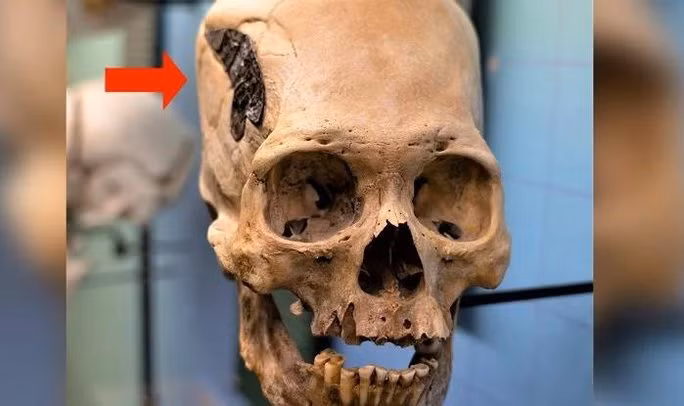 Theo các chuyên gia, hộp sọ trên có nguồn gốc từ Peru, có niên đại khoảng 2.000 tuổi. Hộp sọ có hình dáng thuôn dài được cho có thể là xuất phát từ tập tục cổ xưa của người Peru. Vào thời cổ đại, người lớn sẽ thực hiện các giải pháp nhằm siết chặt đầu trẻ em để tạo hình sọ dài.