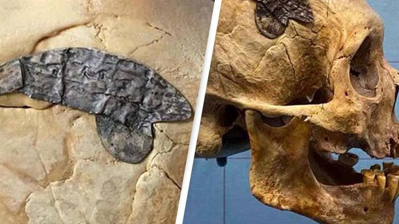 Trong quá trình trepanation, người bệnh sẽ được thầy thuốc đục lỗ trên hộp sọ để trị một vấn đề nào đó về sức khỏe rồi sau đó được ghép một mảnh kim loại. Việc một mảng sọ được thay thế bằng miếng kim loại lớn có thể được xem là bằng chứng cho thấy người xưa đã thực hiện các thủ thuật phẫu thuật và y tế phức tạp.