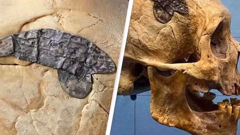 Trong quá trình trepanation, người bệnh sẽ được thầy thuốc đục lỗ trên hộp sọ để trị một vấn đề nào đó về sức khỏe rồi sau đó được ghép một mảnh kim loại. Việc một mảng sọ được thay thế bằng miếng kim loại lớn có thể được xem là bằng chứng cho thấy người xưa đã thực hiện các thủ thuật phẫu thuật và y tế phức tạp.