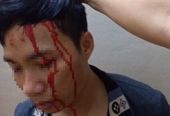 Mua tiet lon, ru nguoi yeu dung man kich tong tien me de-Hinh-2