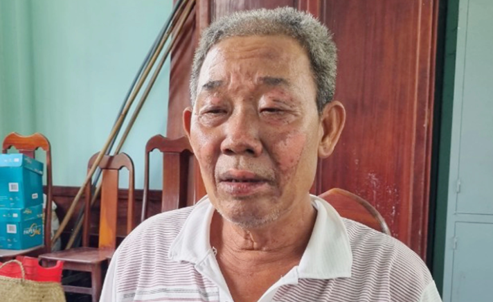 Do quần áo dính máu của ông Sáng nên y đã lột ra để trên giường rồi nảy sinh ý định đốt xác nạn nhân để phi tang… Nhưng lúc này thấy còn sớm (khoảng hơn 20h), sợ mọi người phát hiện nên bỏ ra về. (Ảnh Zing.vn)