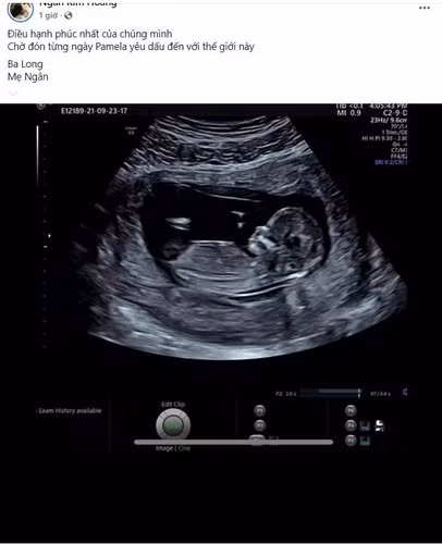 Trong ngày đầu tiên của năm mới, hot girl Hà thành gây chú ý khi khoe sắp lên chức. Theo đó, chia sẻ hình ảnh siêu âm thai, Salim viết: "Điều hạnh phúc nhất của chúng mình. Chờ đón từng ngày Pamela yêu dấu đến với thế giới này".