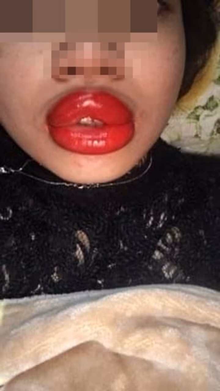 Những sản phẩm lỗi sau khi thực hiện phun môi được cư dân mạng góp vui, nhiều người không biết nên bày tỏ cảm xúc đau buồn hay thả mặt cười “haha” nữa.