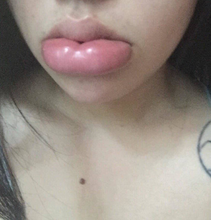 Không hiểu tại sao cô gái ấy lại ra nông nỗi này bởi kỹ thuật phun xăm giờ đã rất hiện đại rồi mà.