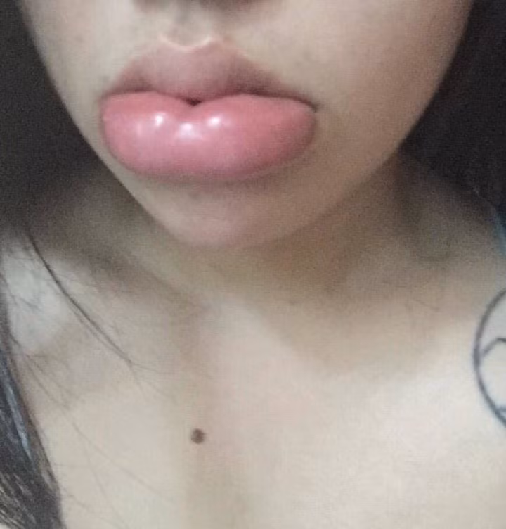 Không hiểu tại sao cô gái ấy lại ra nông nỗi này bởi kỹ thuật phun xăm giờ đã rất hiện đại rồi mà.