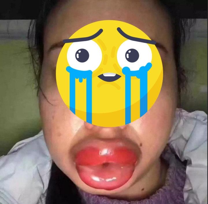 Dù ai cũng hiểu, là phụ nữ luôn cần làm đẹp, thế nhưng hãy cẩn thận khi lựa chọn cơ sở thẩm mỹ uy tín để trao gửi niềm tin.