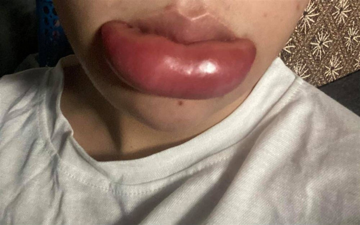 Thế nhưng không phải ai cũng may mắn để có được sản phẩm ưng ý, trên MXH đã xuất hiện khá nhiều thảm họa phun xăm môi làm netizen phải "sang chấn tâm lý".