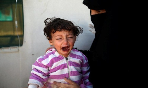 Theo hãng thông tấn Reuters, dịch tả lại bùng phát ở Yemen giữa lúc quốc gia Trung Đông này đang trải qua cuộc khủng hoảng nhân đạo cấp bách nhất khiến 10 triệu người đứng trước bờ vực của nạn đói. (Nguồn ảnh: Reuters)