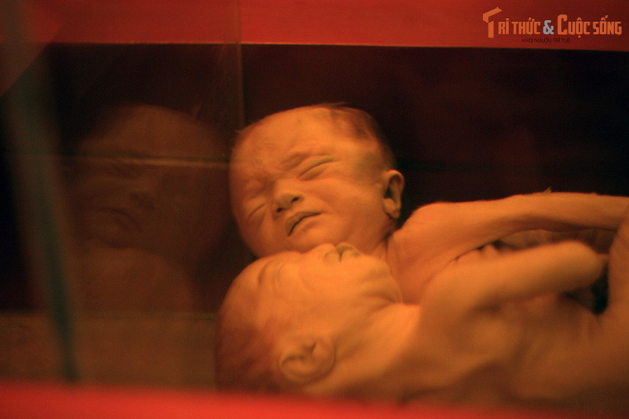  6. Chuyên đề chất độc da cam để lại ám ảnh sâu sắc. Khu vực trưng bày về hậu quả chất độc da cam có thể gây ám ảnh cho du khách, với những hình ảnh và hiện vật về di chứng lâu dài trên con người và môi trường.