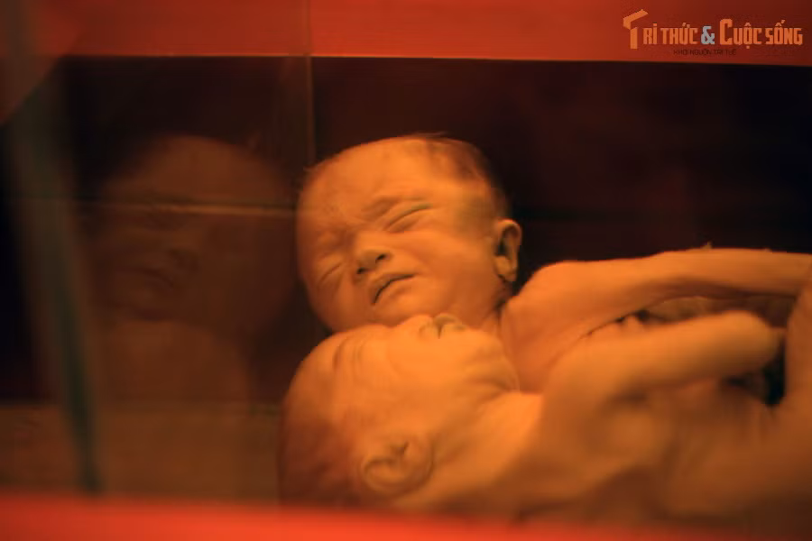  6. Chuyên đề chất độc da cam để lại ám ảnh sâu sắc. Khu vực trưng bày về hậu quả chất độc da cam có thể gây ám ảnh cho du khách, với những hình ảnh và hiện vật về di chứng lâu dài trên con người và môi trường.