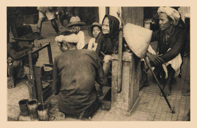 Một người giác hơi rong hành nghề trên đường phố Sài Gòn. Ảnh: Public Domain.