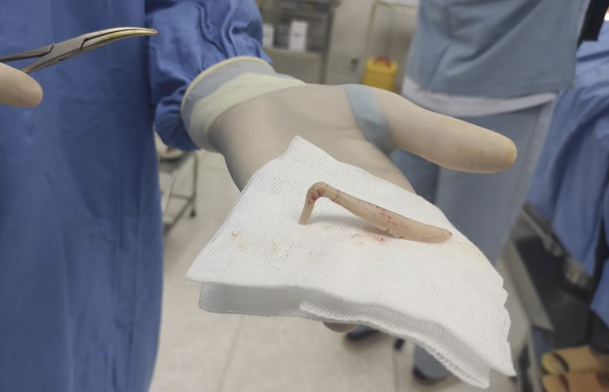 Co gai 28 tuoi lanh hau qua nang ne khi lam dep o tham my vien-Hinh-3