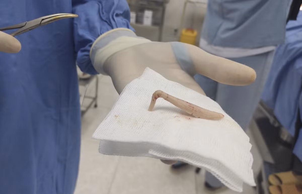 Co gai 28 tuoi lanh hau qua nang ne khi lam dep o tham my vien-Hinh-3