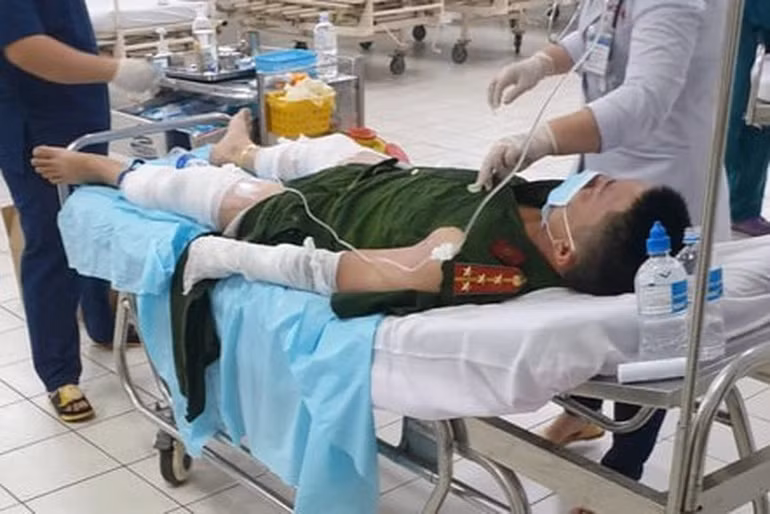 Dien bien vu tat xang phong hoa lam 4 can bo cong an bi thuong