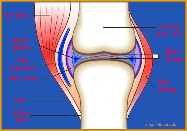 Canh bao benh thoai hoa khop o nguoi tre, cach nao de phong ngua?-Hinh-2