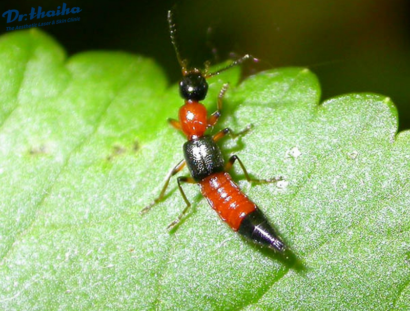 Đến hẹn lại lên, cứ sau mỗi vụ gặt lúa người dân lại được phen hoảng loạn vì sự "đổ bộ" của kiến ba khoang ở khắp ngóc ngách trong nhà. Đối với con người, kiến ba khoang là loài côn trùng nguy hiểm, ''đốt'' người sưng tấy và cực độc bởi vậy cần phải tiêu diệt ngay khi bắt gặp.