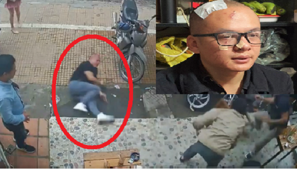 Vo su Tap doan Lien Minh danh nguoi vi che khu du lich Quy Nui xau