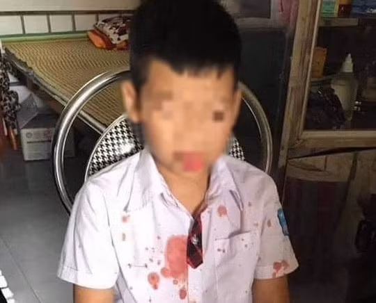  4. Con mâu thuẫn với bạn, bố tới trường đánh nhập viện: Công an TP Hòa Bình tạm giữ hình sự ông Phạm Duy Đức (SN 1978, ngụ phường Hữu Nghị, TP Hòa Bình) để điều tra, làm rõ hành vi "Cố ý gây thương tích". Theo đó, con ông Đức có mâu thuẫn cùng bé N.G.K. lớp 1, bực tức, ông đến trường lôi cháu bé ra ngoài hành hung, khiến cháu bị thương phải nhập viện.