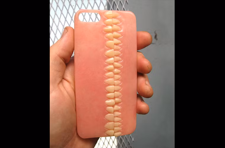 Hàm răng?! Đúng vậy, một chiếc ốp lưng iPhone có nguyên hàm răng người.