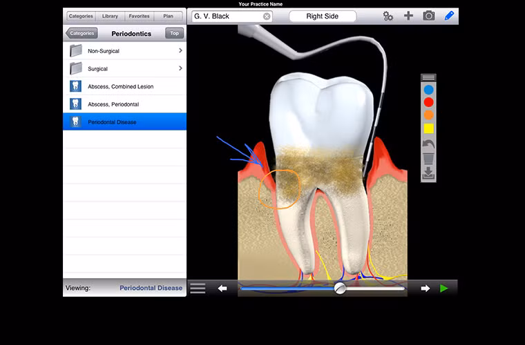  DDS GP Yes! - Giá: 499.99 USD DDS GP Yes! là ứng dụng iPhone, iPad dành cho nha sĩ. Nó hỗ trợ các y bác sĩ nha khoa trong việc giới thiệu bệnh nhân về phác đồ điều trị cụ thể trong một bài trình bày gọn gàng.