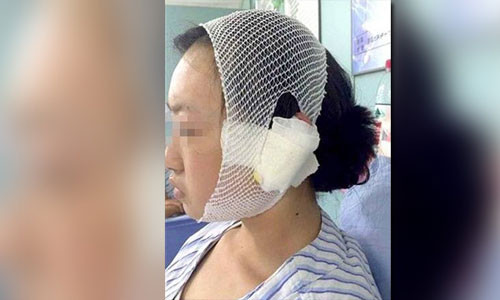 Danh cho, gai tre bi chu cho cat dut tai