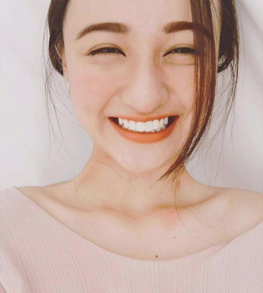 Hàm răng trắng sáng đi cùng một nụ cười rạng rỡ luôn là vũ khí tuyệt vời khiến đối phương không thể rời mắt khỏi bạn - Ảnh minh họa: Internet