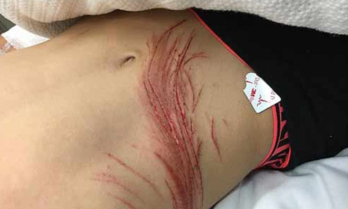 Deo tai nghe iPhone di xe may, suyt mat dau-Hinh-2