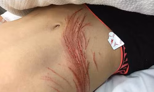 Deo tai nghe iPhone di xe may, suyt mat dau-Hinh-2