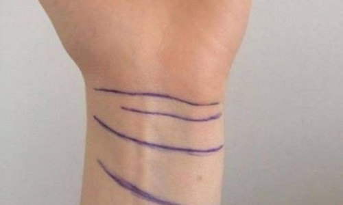 Nhin duong van co tay, biet ngay van menh suong kho-Hinh-4