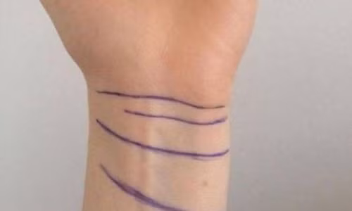 Nhin duong van co tay, biet ngay van menh suong kho-Hinh-4