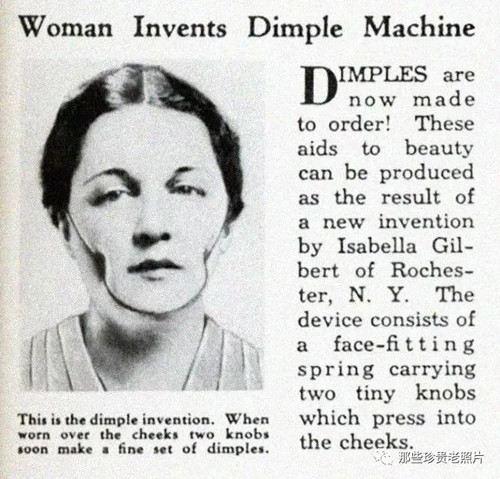 Dụng cụ tạo má lúm đồng tiền rất phổ biến năm 1936. Nhược điểm của dụng cụ này là có thể gây tổn thương cơ nếu dùng quá lâu.