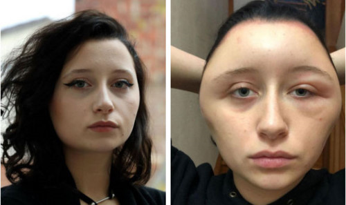 Mat bien dang to nhu qua bong vi nhuom toc