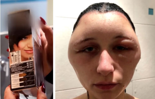 Mat bien dang to nhu qua bong vi nhuom toc-Hinh-2