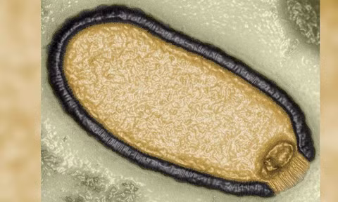 Đã có một số trận dịch tương đối lớn trong lịch sử loài người. Dịch cúm Tây Ban Nha năm 1918 được gọi là căn bệnh truyền nhiễm nguy hiểm nhất trong lịch sử loài người. Ảnh Science Daily